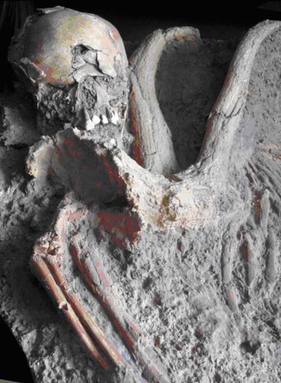 Il y a 100 000 ans, traumatisme, handicap et prise en charge dans la grotte de Qafzeh (Isra&euml;l)