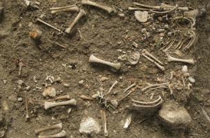 H&ocirc;pital protestant, rue du Docteur Schweitzer