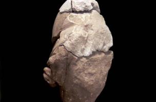 Clinique Saint-Louis